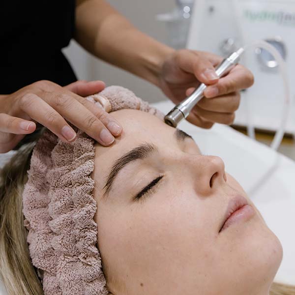 The Top 5 Benefits of Microdermabrasion