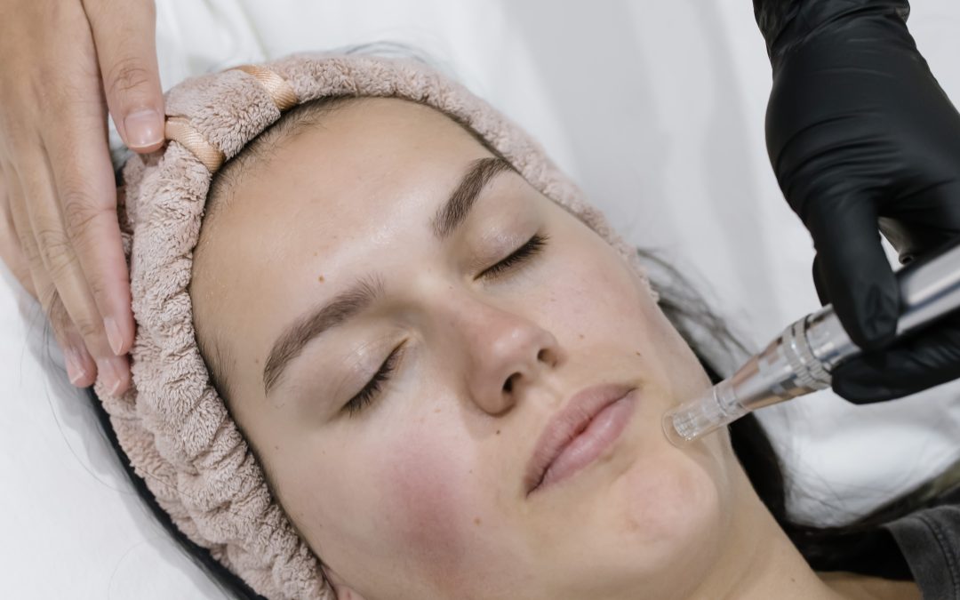 Reveal Radiant Skin with Skin Needling
